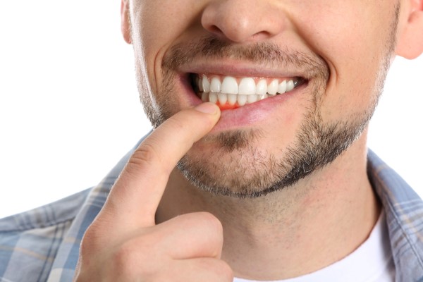 Can Gum Disease Be Treated At Home?